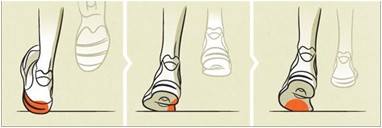 Bilder 4Pronation